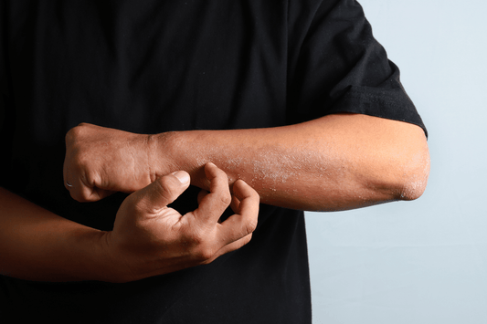 Lidocaine Ointment USP 5%: Topical Uses, Application, and Side Effects